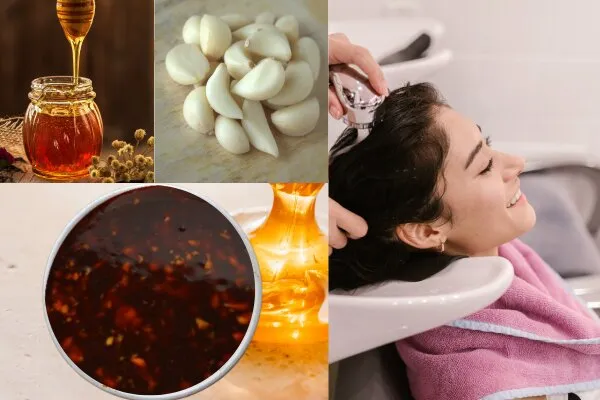 Dandruff Treatment at Home - डैंड्रफ का इलाज | Top 10 Remedies!